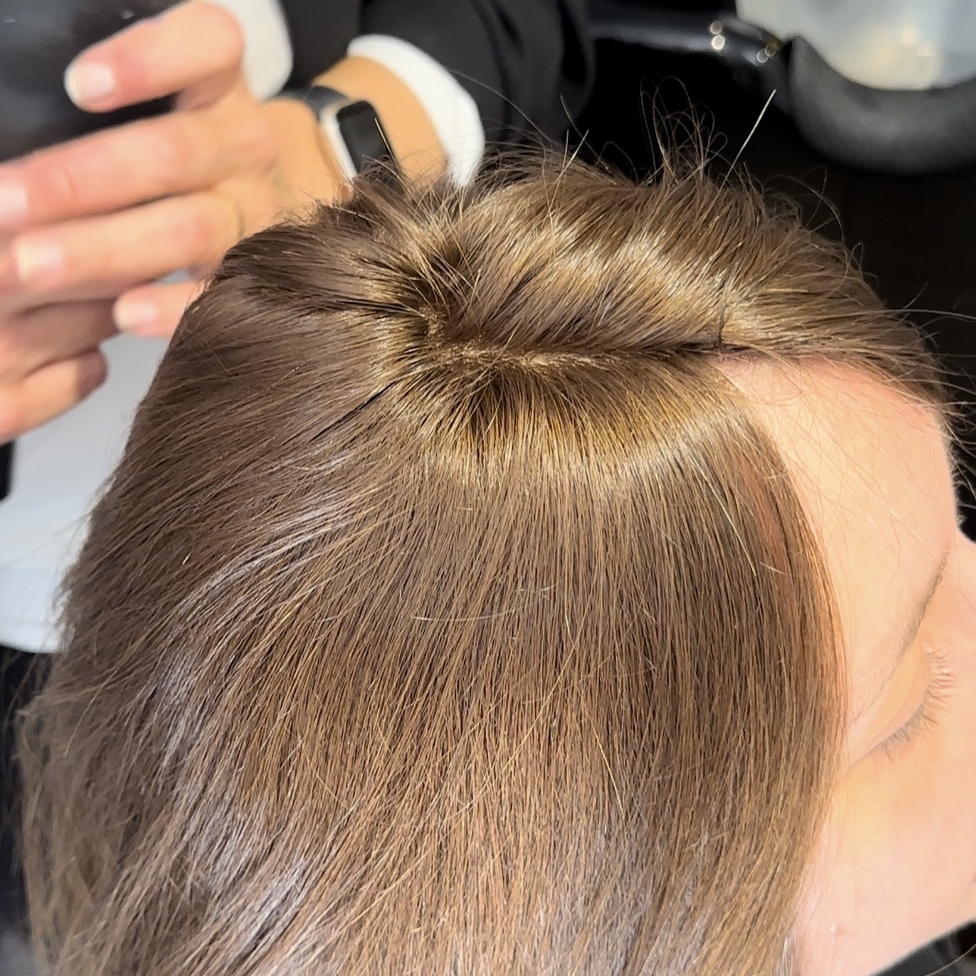 Nachher – Frau mit CNC Haarsystem